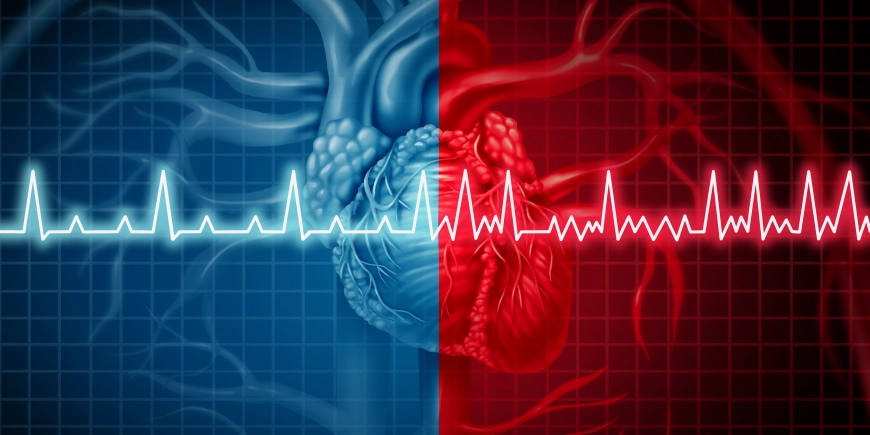 Got AFib? Let's Talk About: The 'ABC' Maze Surgical Procedure...